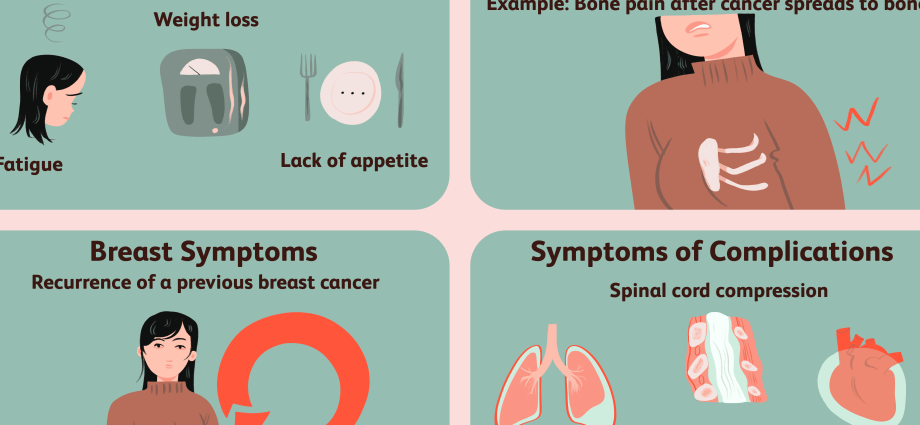 Atypical symptoms of breast cancer. The oncologist advises what to look for