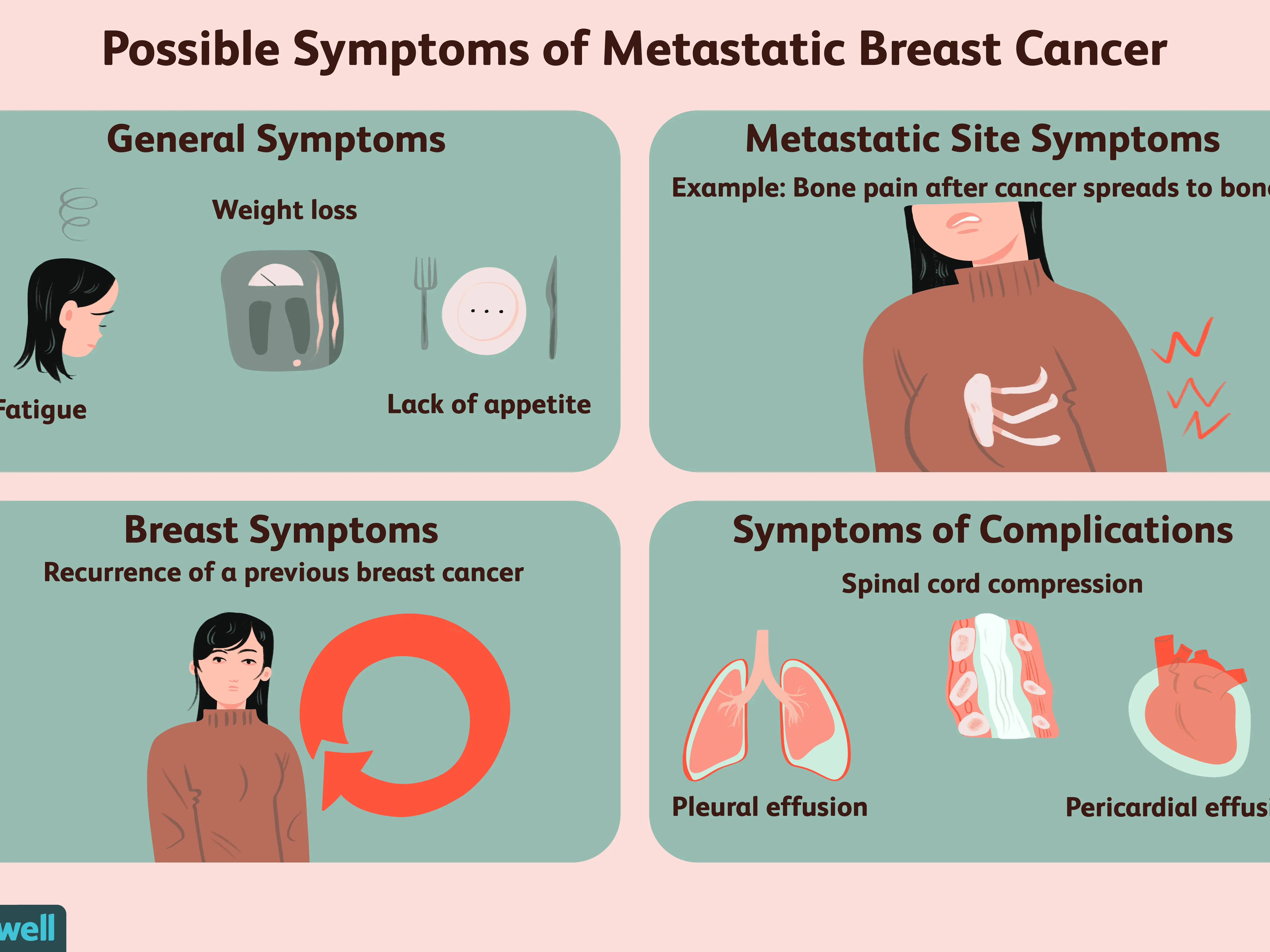 Atypical symptoms of breast cancer. The oncologist advises what to look for