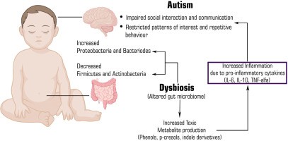 Autism can start in the gut