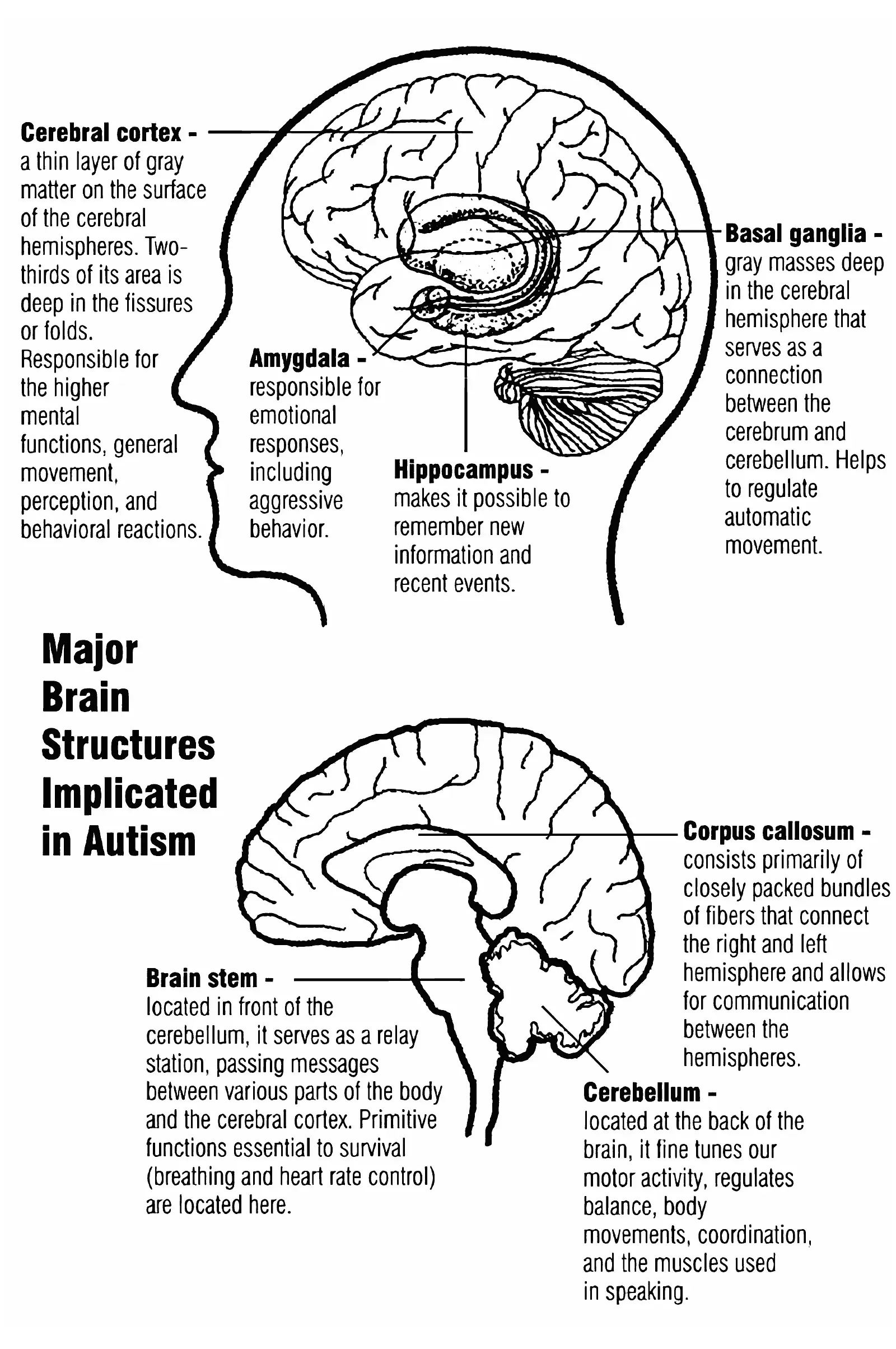 Autism &#8211; causes