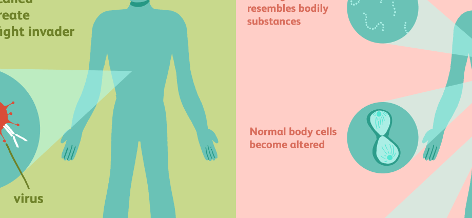 Autoimmune diseases &#8211; types, causes, diagnosis, treatment. What are they characterized by? WE EXPLAIN