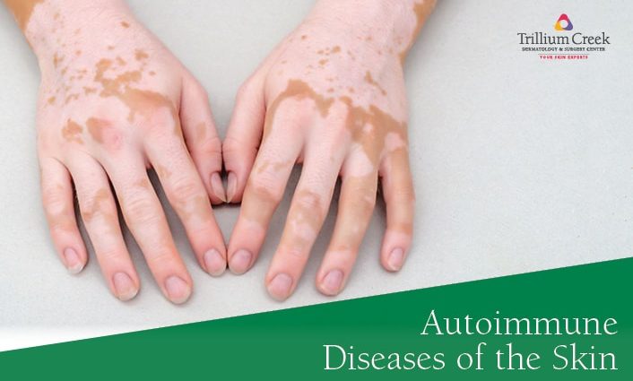 Autoimmune skin diseases