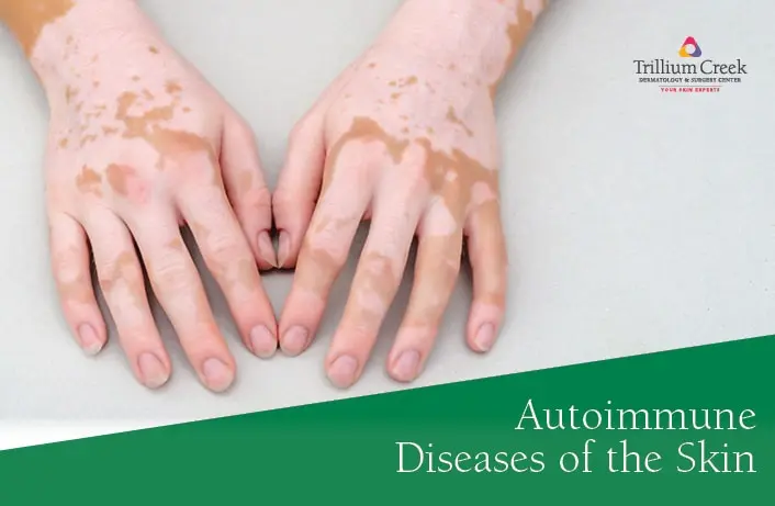 Autoimmune skin diseases