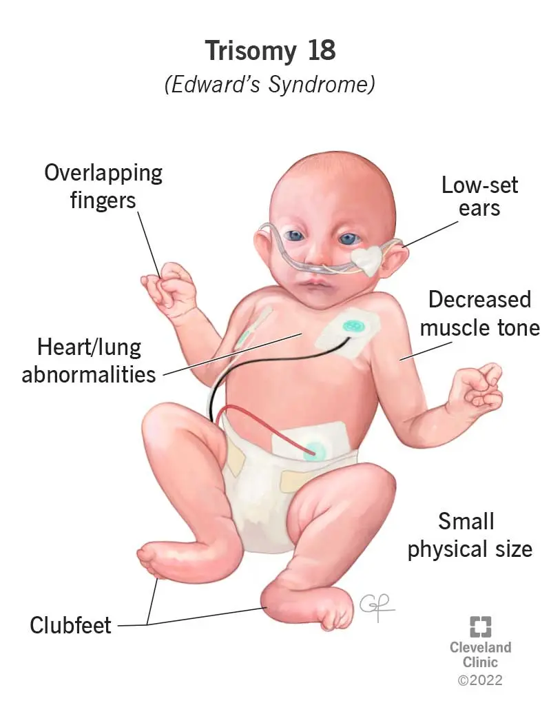 Baby&#8217;s chromosomes under full control