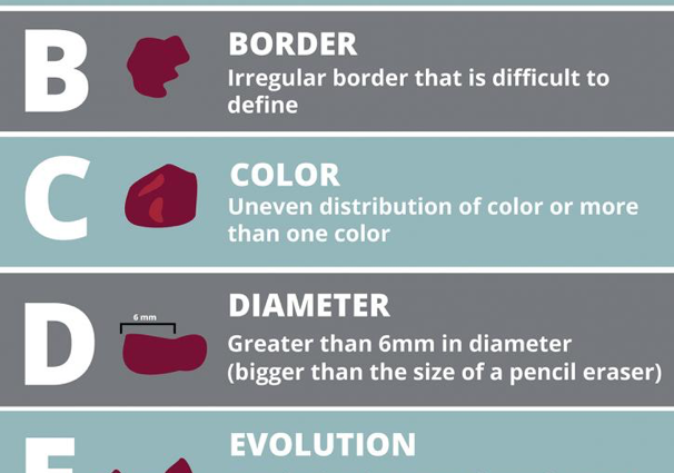 Be sure to have your skin checked after the summer. Early detection of melanoma is almost 100%. curable