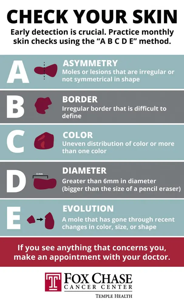 Be sure to have your skin checked after the summer. Early detection of melanoma is almost 100%. curable