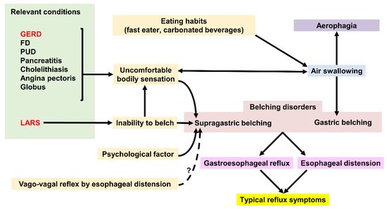 Belching &#8211; characteristics, causes, diagnosis, treatment