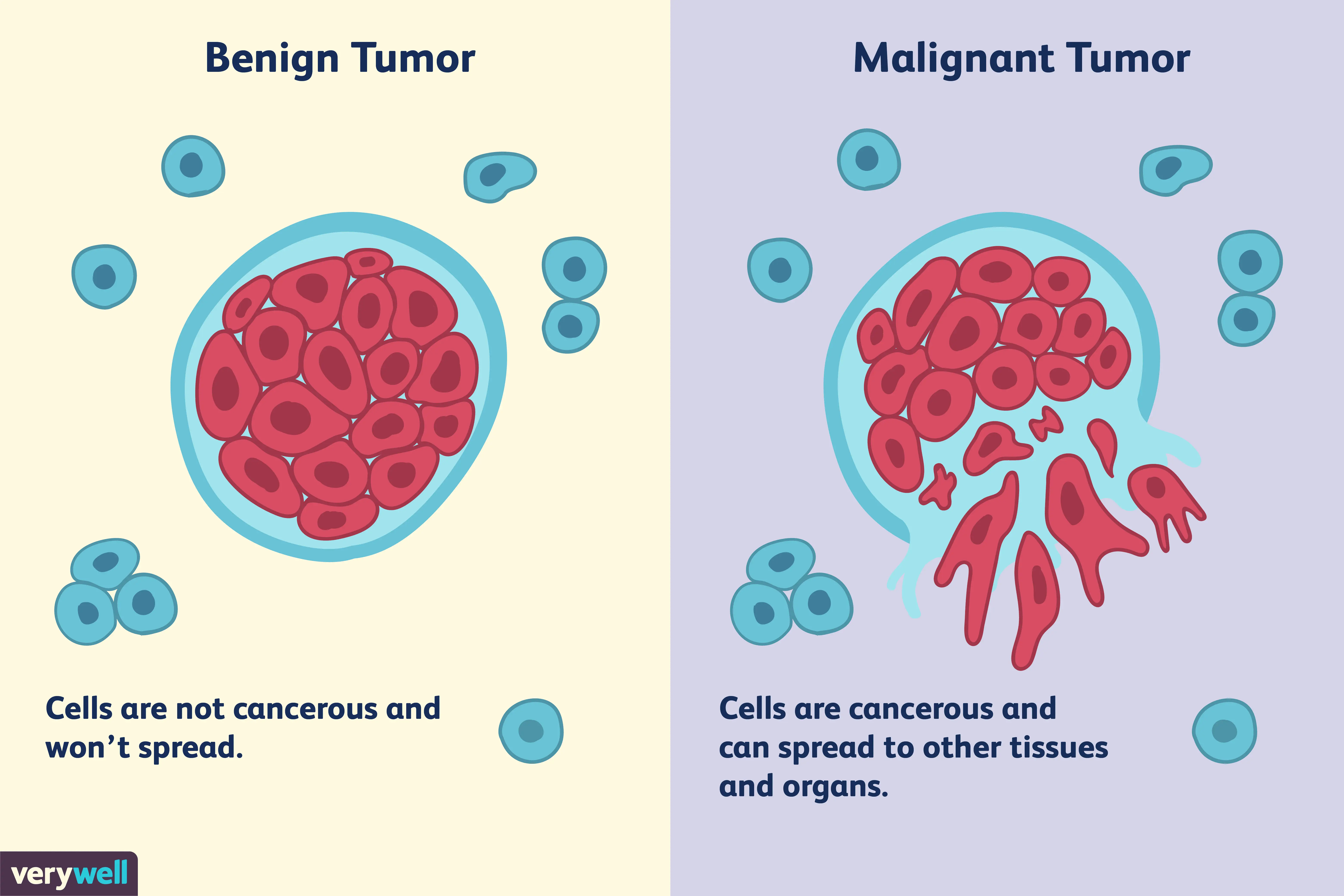 Does Malignant Cells Mean Cancer