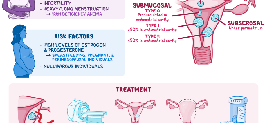 Benign neoplasms of the uterus &#8211; symptoms and treatment