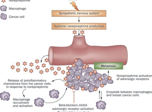 Beta-blockers against breast cancer