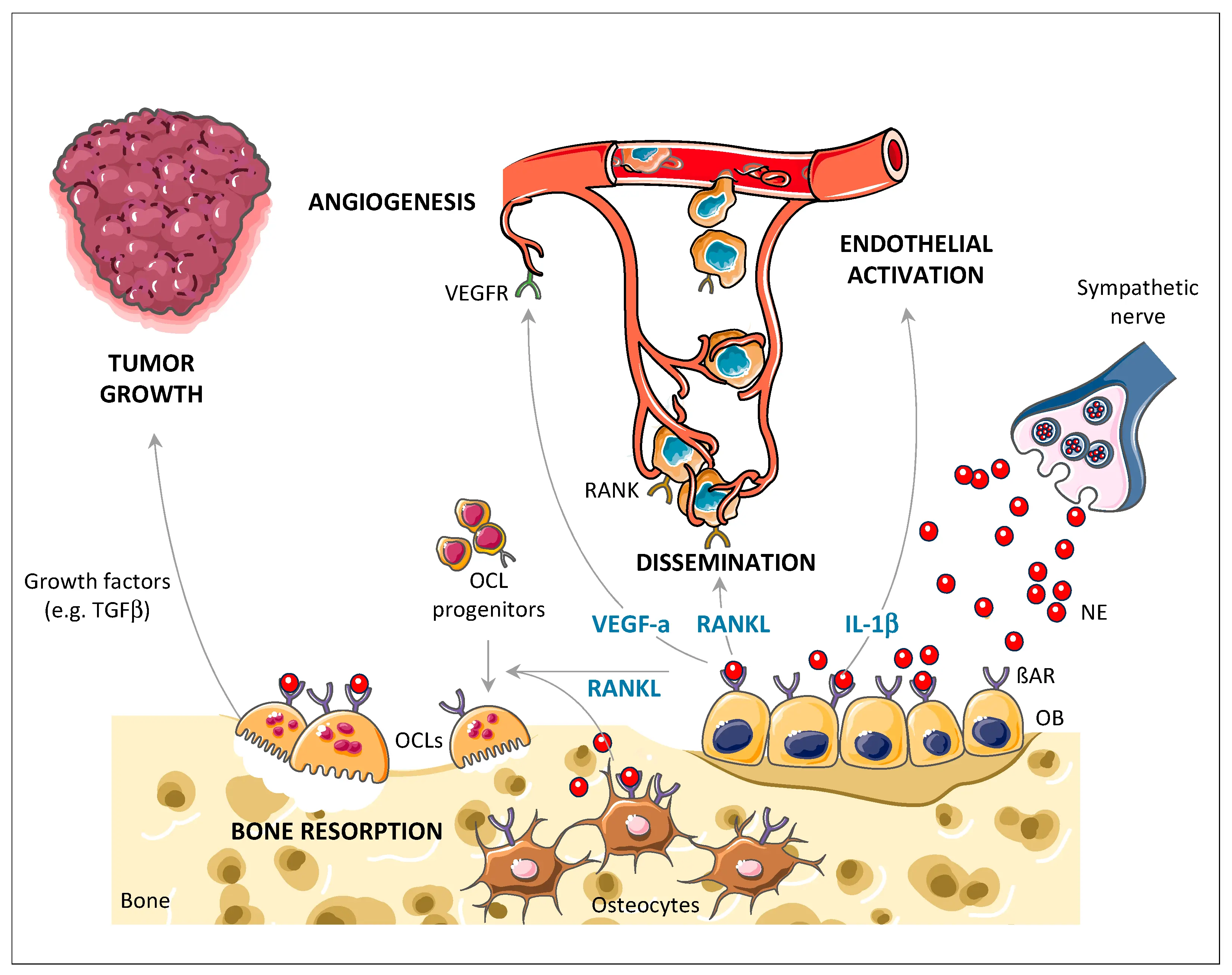 Beta-blockers can prevent breast cancer metastasis