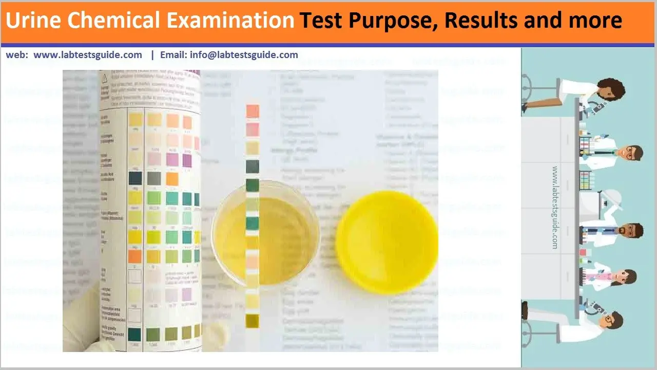 Bilirubin &#8211; examination, norms, elevated levels. What does bilirubin in urine mean?