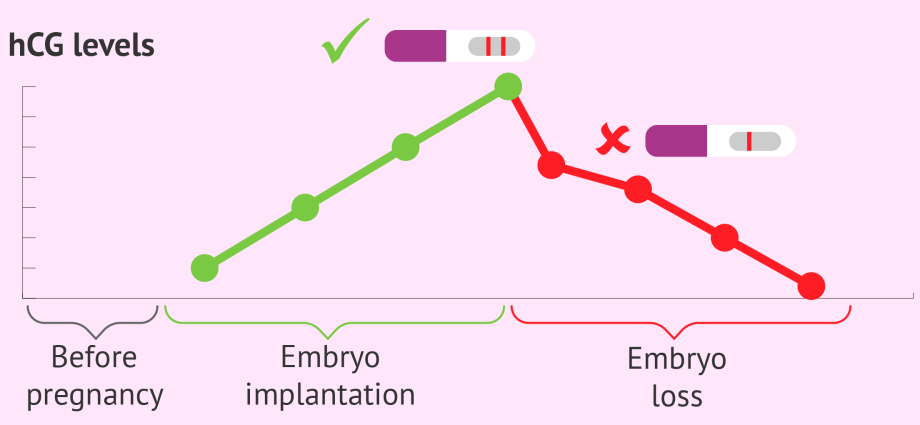 Biochemical pregnancy &#8211; definition, biochemical and in vitro pregnancy