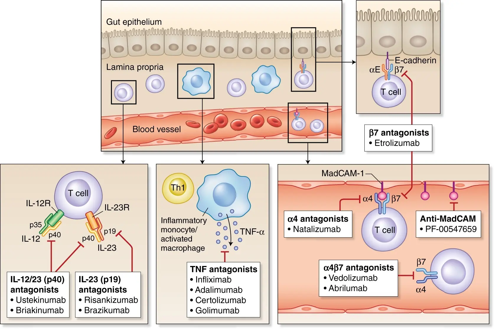 Biological therapy for Colitis Ulcerosa