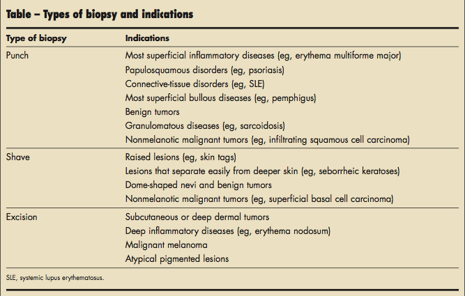 Biopsy &#8211; indications, types. How to prepare for a biopsy?