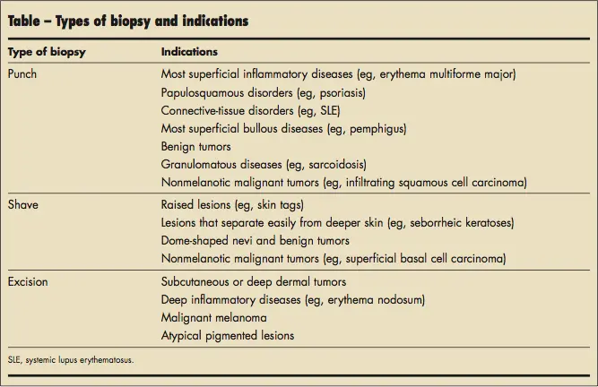 Biopsy &#8211; indications, types. How to prepare for a biopsy?