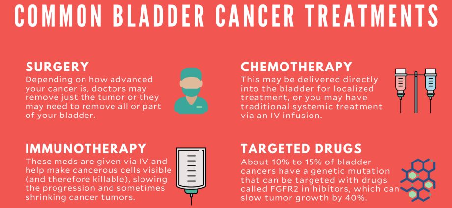 Bladder cancer &#8211; causes, symptoms, treatment. When is the bladder removed?