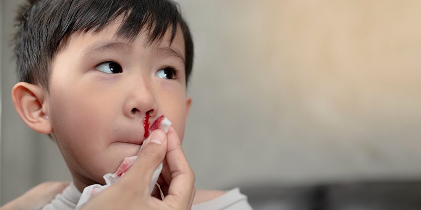 Bleeding from the nose in a child &#8211; what could it be?