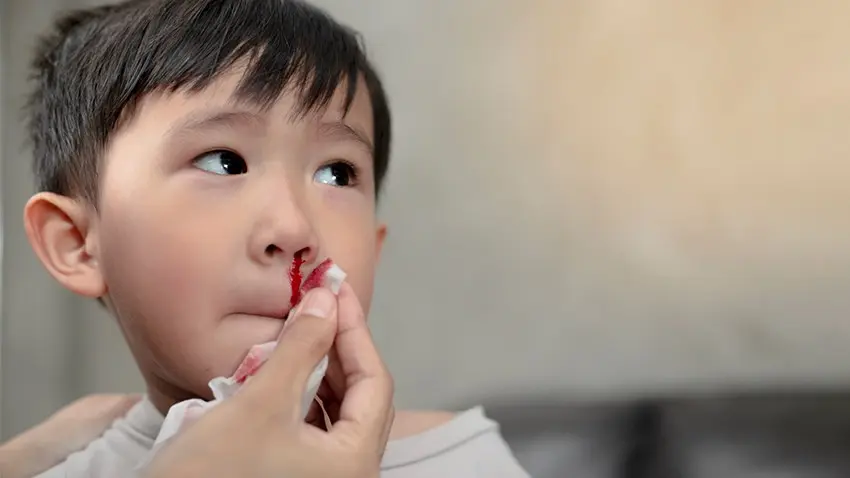 Bleeding from the nose in a child &#8211; what could it be?