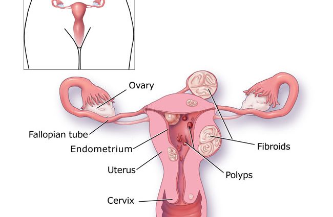 Bleeding from the reproductive organ &#8211; division and causes