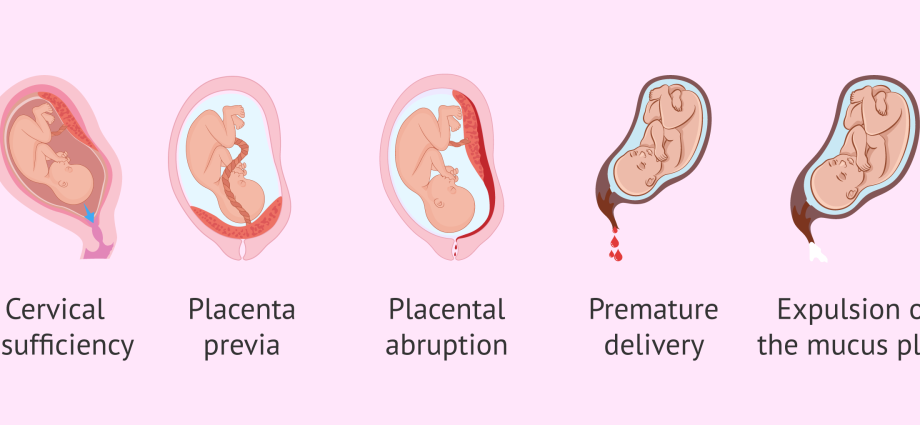 Bleeding in pregnancy &#8211; the main causes. Why should a doctor be consulted when bleeding during pregnancy?