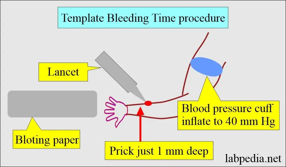 Bleeding time