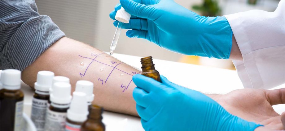 Blood allergy tests &#8211; how do they work and how much do they cost?