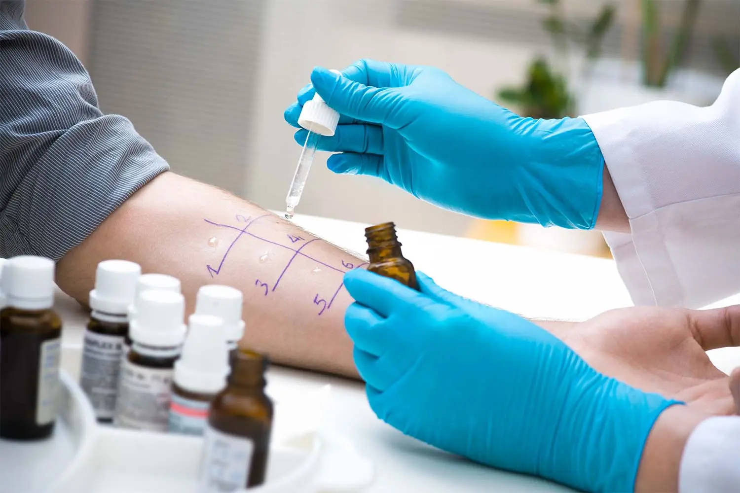 Blood allergy tests &#8211; how do they work and how much do they cost?