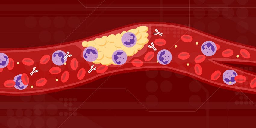 Blood clots can appear not only because of COVID-19