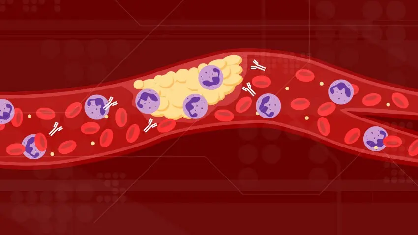 Blood clots can appear not only because of COVID-19