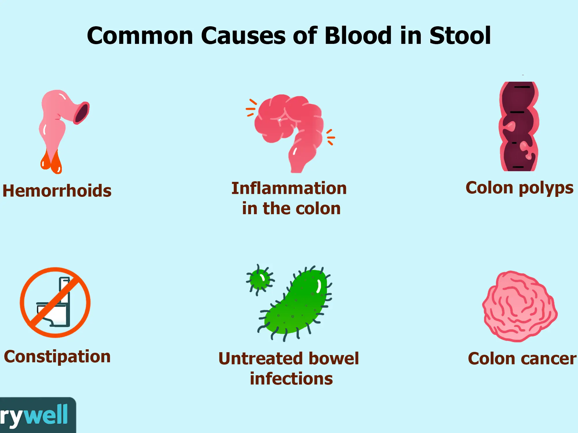 Blood in the stool &#8211; does it mean colon cancer?