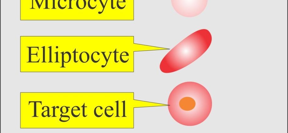 Blood morphology &#8211; how often to test? Adult morphology interpretation