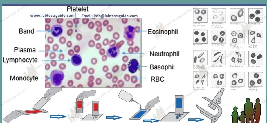 Blood morphology &#8211; what is this test, what are the standards?