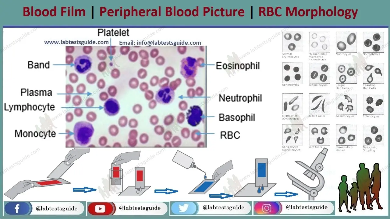 Blood morphology &#8211; what is this test, what are the standards?