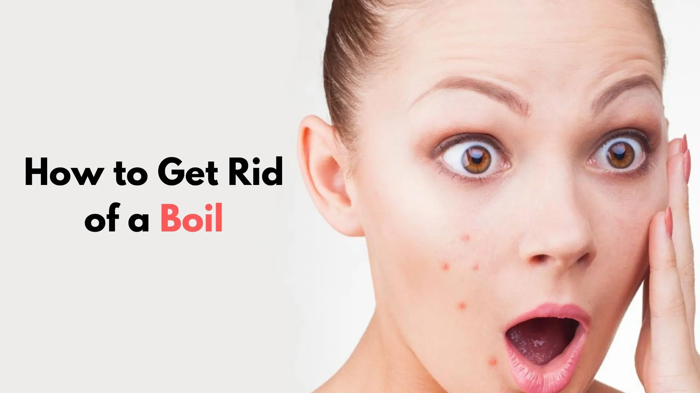 Boil &#8211; causes, symptoms, treatment, home remedies. How to remove a boil?