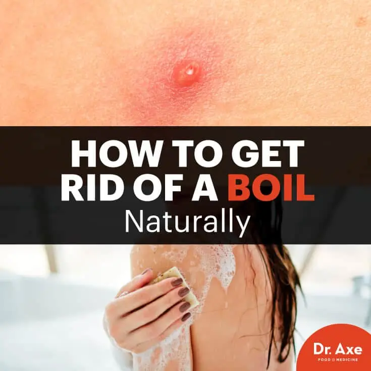 Boil &#8211; symptoms, treatment. How to avoid a boil?