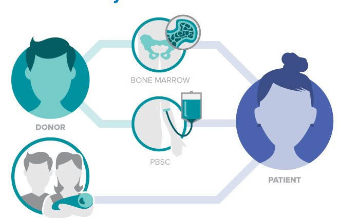 Bone marrow donor &#8211; indications, contraindications, course of the procedure. How to become a bone marrow donor?