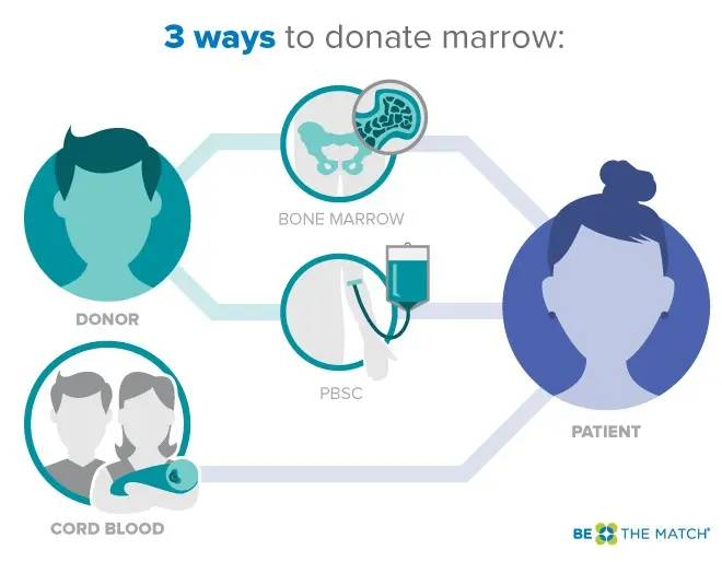 Bone marrow donor &#8211; indications, contraindications, course of the procedure. How to become a bone marrow donor?