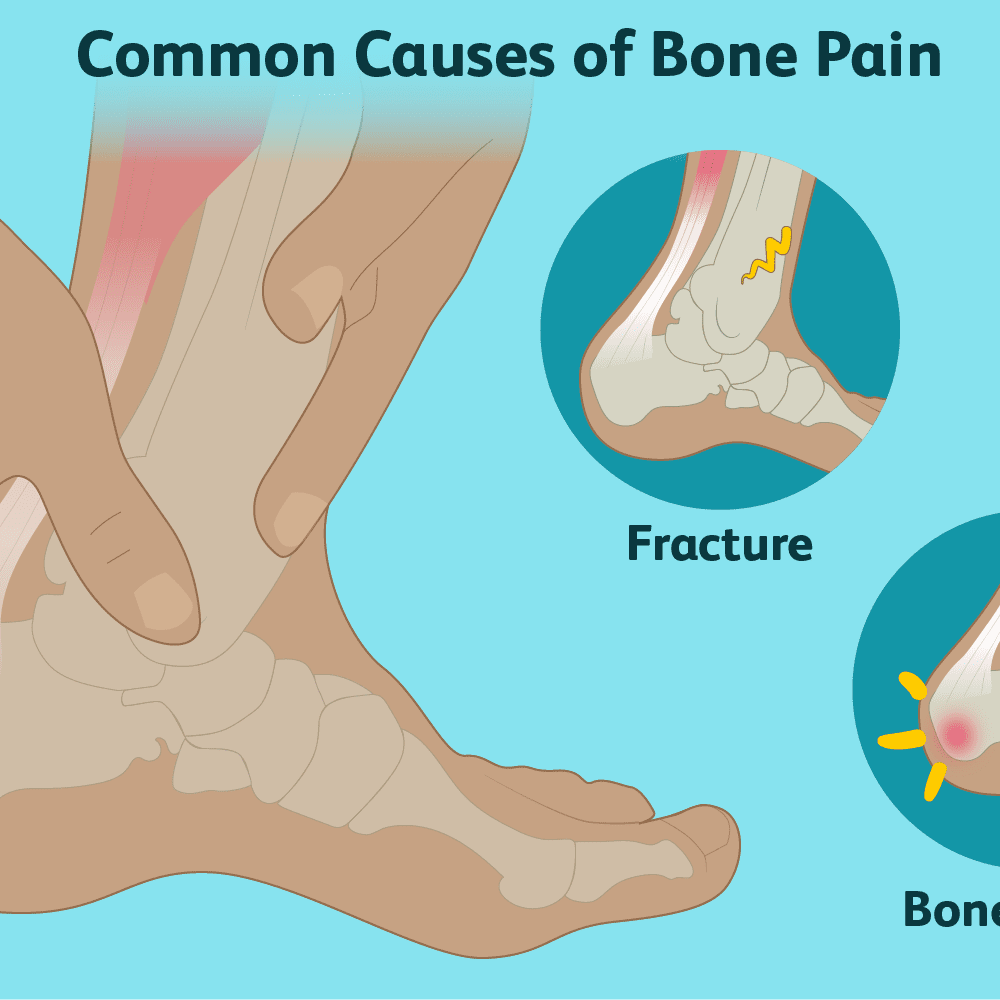 bone-pain-learn-about-the-most-common-causes-of-bone-pain-healthy