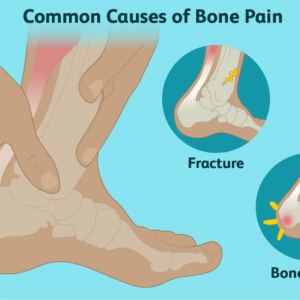 Bone pain &#8211; learn about the most common causes of bone pain