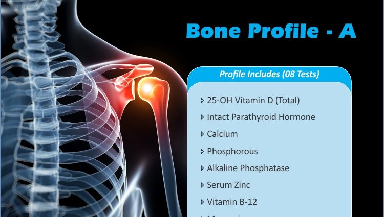 Bone profile &#8211; what tests does it contain?