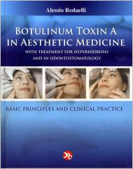 Botulinum toxin &#8211; use in aesthetic medicine. Can botulinum toxin be harmful?