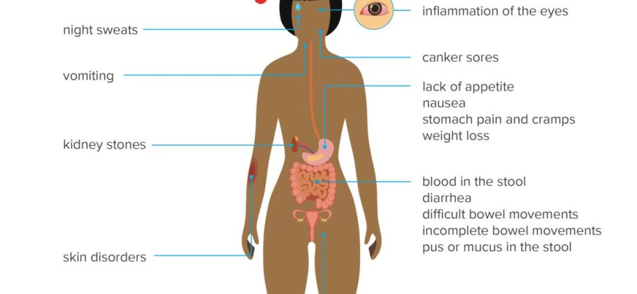 Bowel diseases &#8211; how to recognize them and how to treat them?