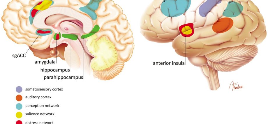 Brain reorganization heals tinnitus