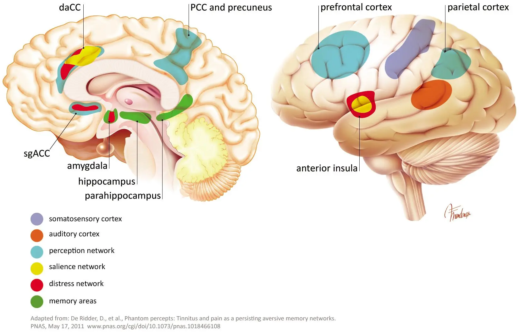 Brain reorganization heals tinnitus