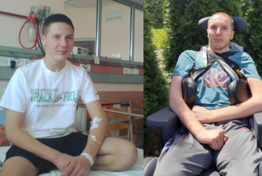 Brain stem tumor &#8211; what is life with the disease like? The story of Maciek Paczuła