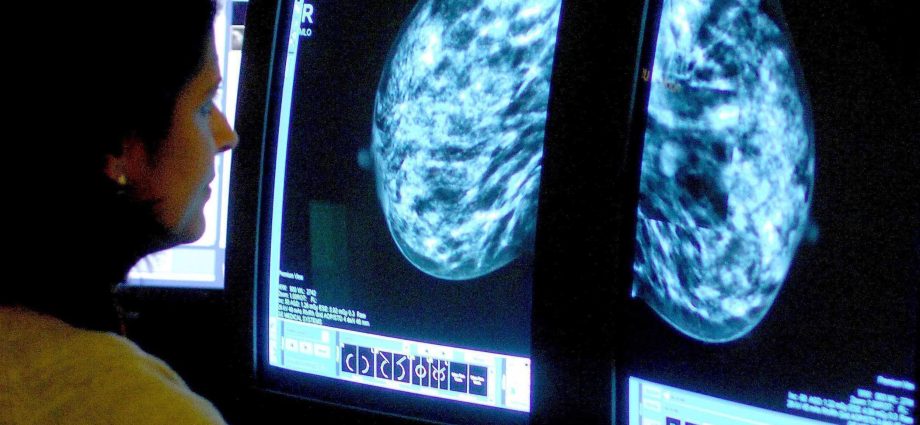 Breakthrough in the treatment of breast cancer? US scientists have good news