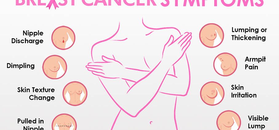 Breast cancer &#8211; symptoms, treatment