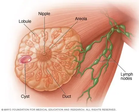 Breast lumps under control