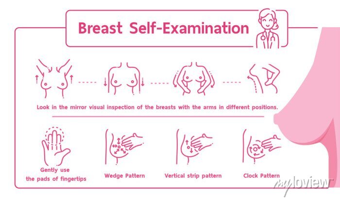 Breast self-examination &#8211; how to do it